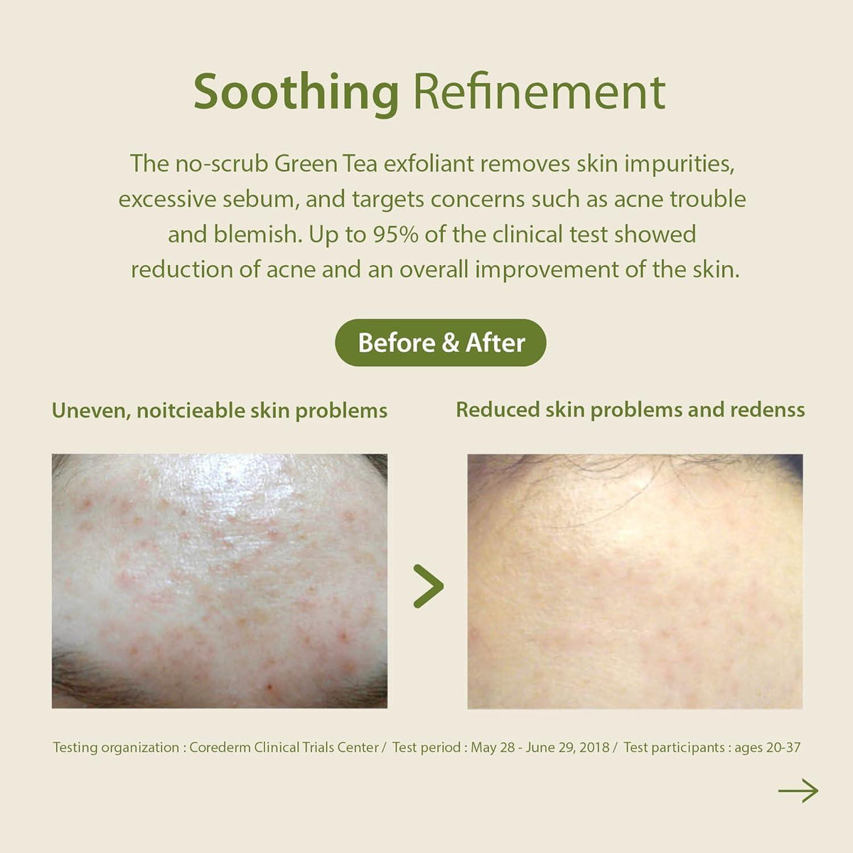 Blithe Patting Splash Mask Soothing & Healing Green Tea 150ml product detail image 7