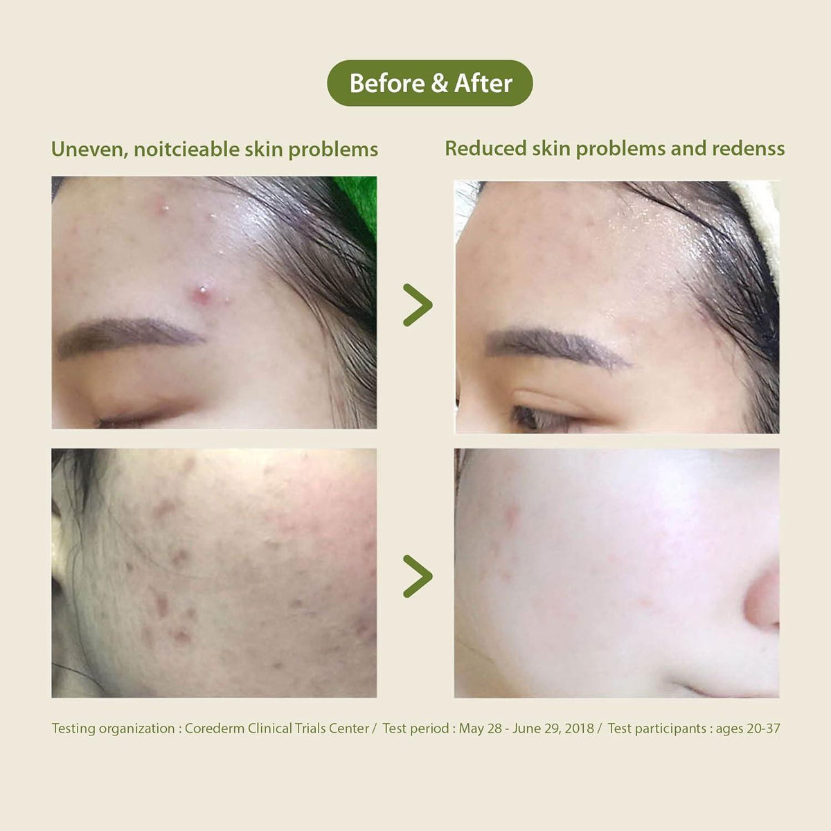 Blithe Patting Splash Mask Soothing & Healing Green Tea 150ml product detail image 8