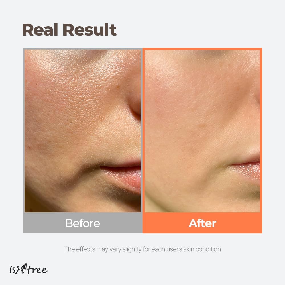 Isntree Green Tea Fresh Toner 200ml — Toners & Astringents product image 58