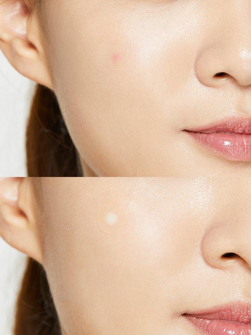 COSRX Acne Pimple Master Patch 24ea — product detail image 6