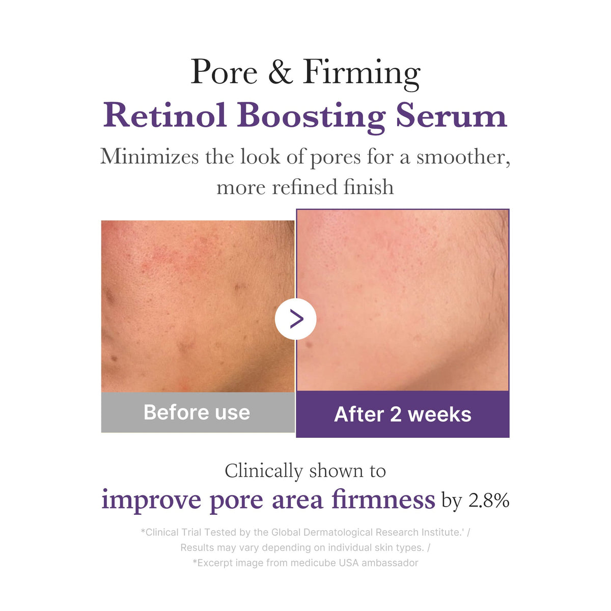 Medicube Retinol Boosting Serum 30ml product image 5
