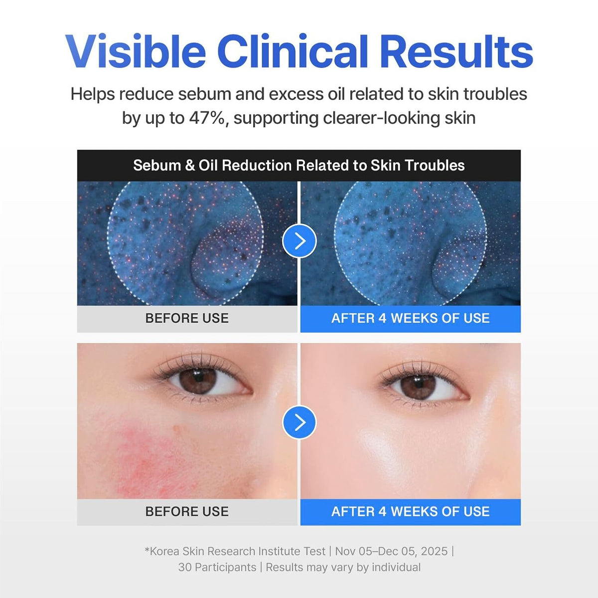 Centellian24 Madeca Cream Hydra Calming 50ml_FOC - 50ml — product detail image 5