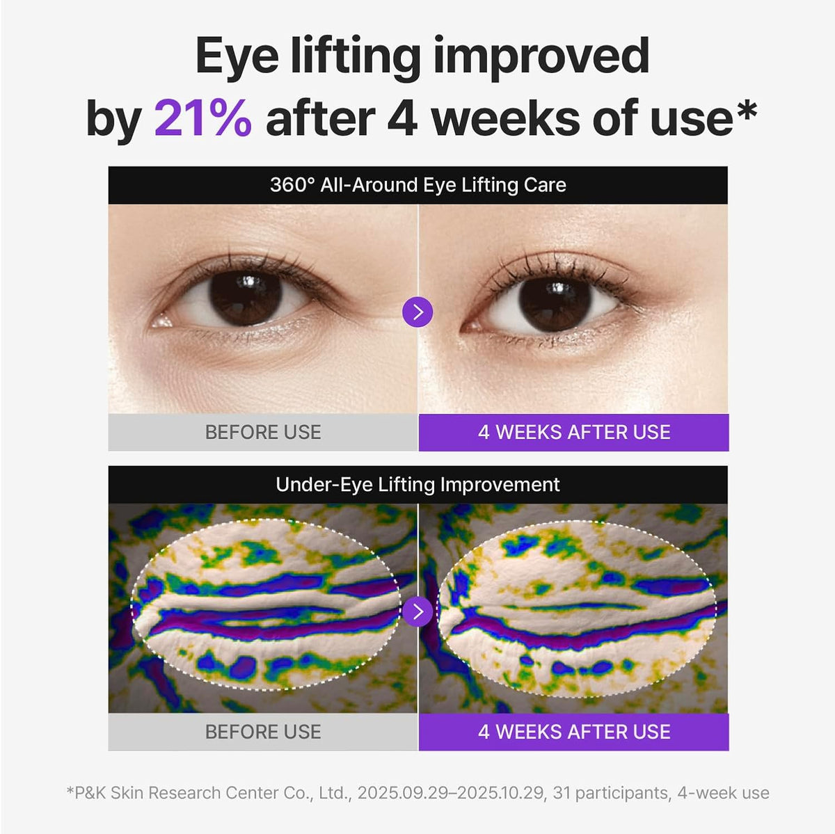 Centellian24 360º Shot PDRN Lifting Eye Cream 30ml Twin Pack (2 × 30ml); official product image 4