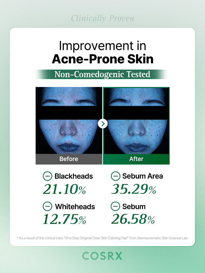 COSRX One Step Original Clear Skin Calming Pad 100ea — product detail image 5