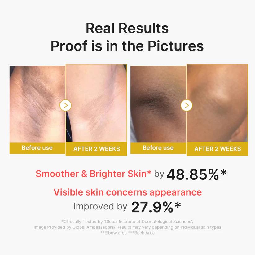 Medicube Kojic Acid Turmeric Body Peel Shot 280ml product image 4