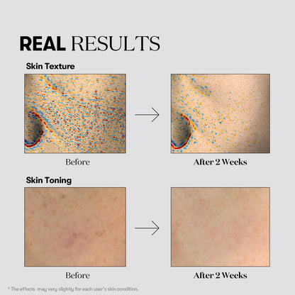 VT Cosmetics TX-Toning Essence 1000 Shot 30ml - official product image 6
